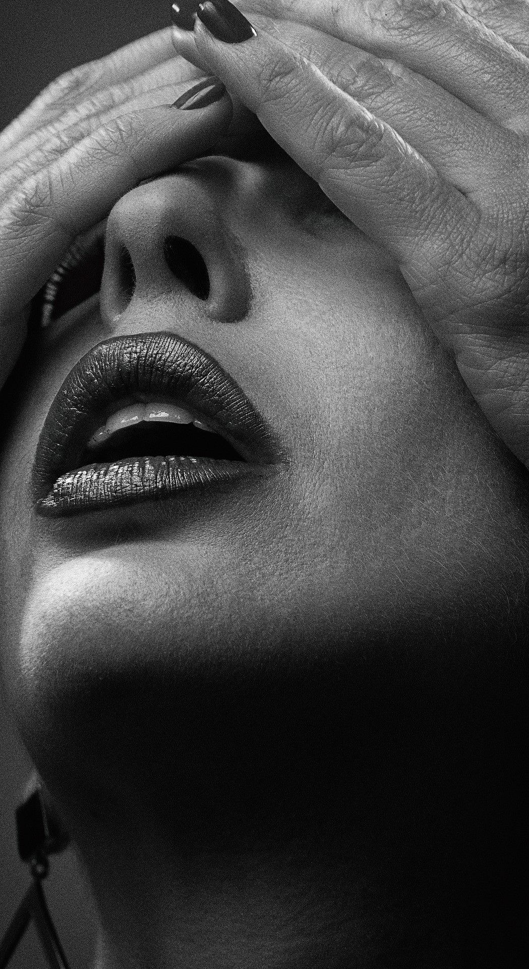 Lip Lift - Professional Treatment